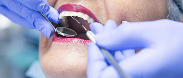 Best Urgent Care for Lost Fillings or Crowns in Canton Valley, CT